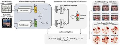 Multimodal explainable AI predicts upcoming speech behavior in adults who stutter